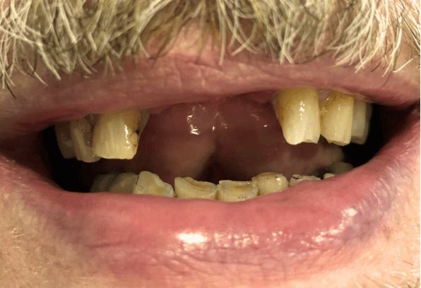 Before - Stamford Dental Care