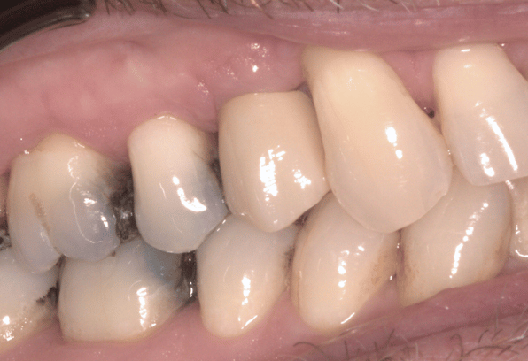 After - Stamford Dental Care