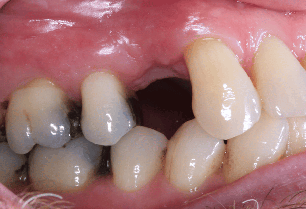 Before - Stamford Dental Care