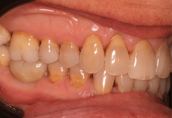 After - Stamford Dental Care