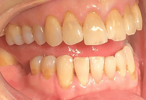 Before - Stamford Dental Care