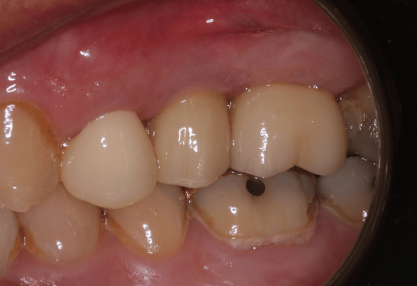 After - Stamford Dental Care