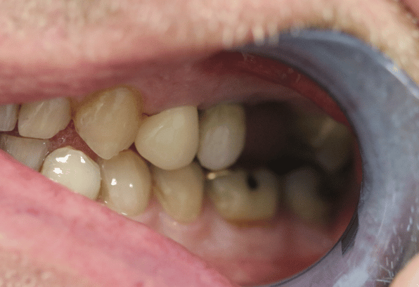 Before - Stamford Dental Care