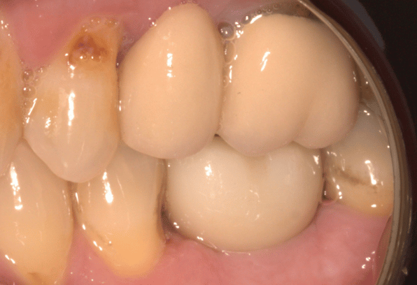 After - Stamford Dental Care