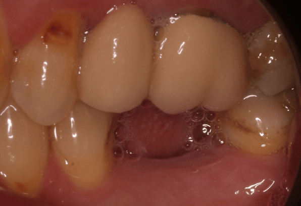 Before - Stamford Dental Care