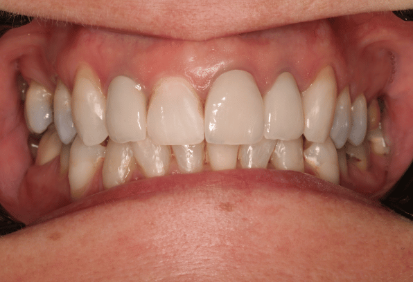 After Face - Stamford Dental Care