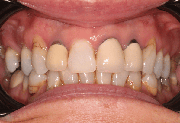 Before- Face - Stamford Dental Care