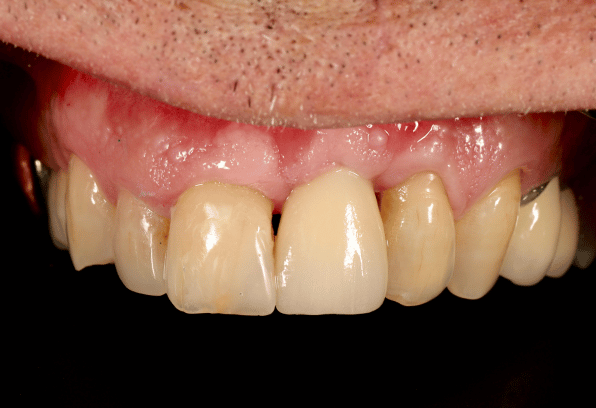 After - Stamford Dental Care