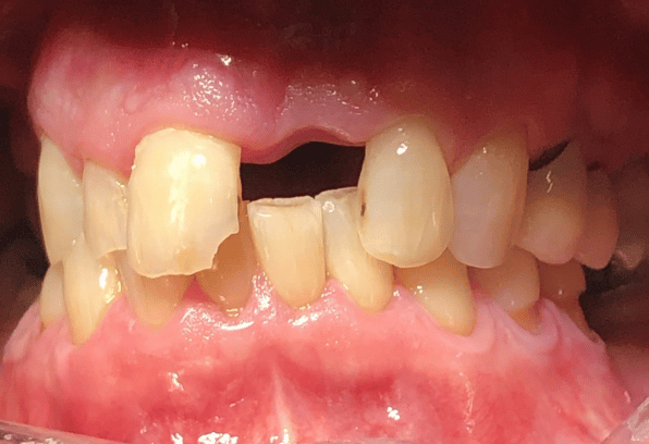 Before - Stamford Dental Care