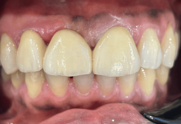 After - Stamford Dental Care