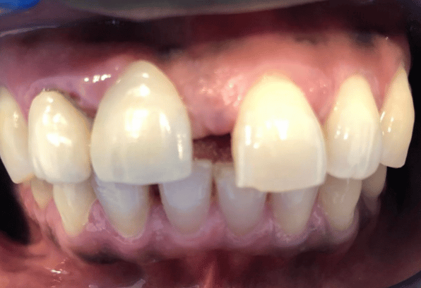 Before - Stamford Dental Care