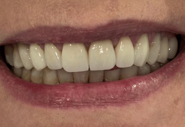 After Face - Stamford Dental Care