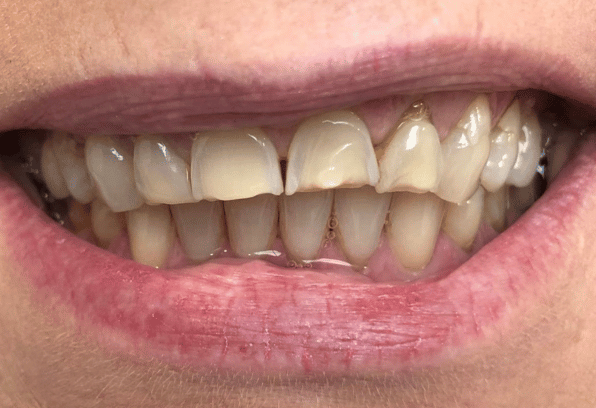 Before- Face - Stamford Dental Care