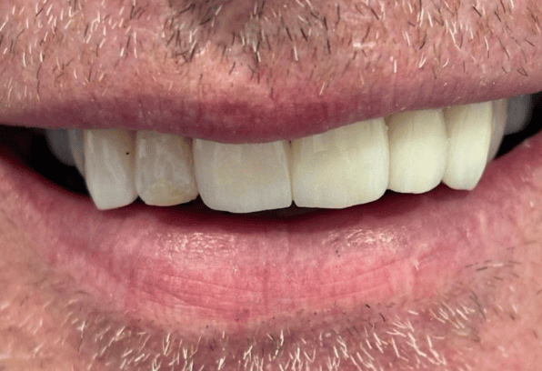 After - Stamford Dental Care