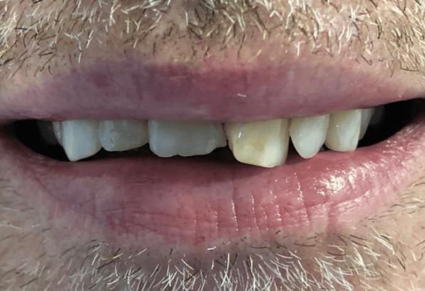 Before - Stamford Dental Care
