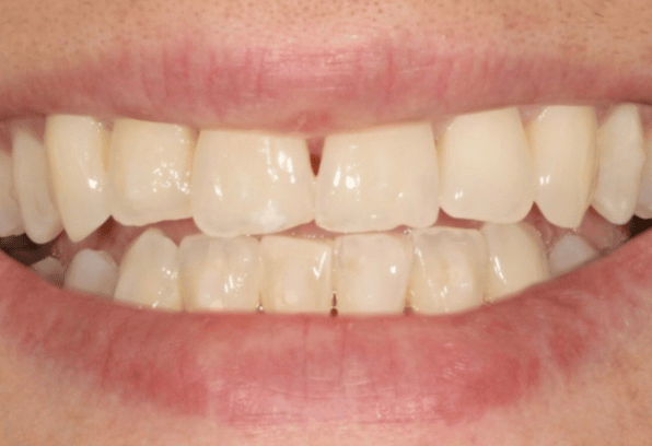 After - Stamford Dental Care