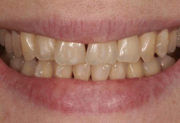 Before - Stamford Dental Care